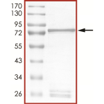 MET (D1228H), Active